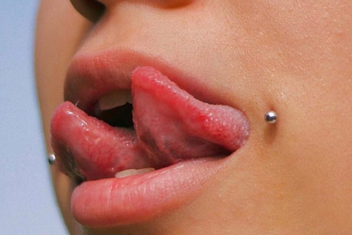 Tongue splitting