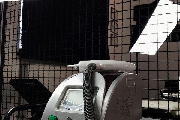 Laser removal
