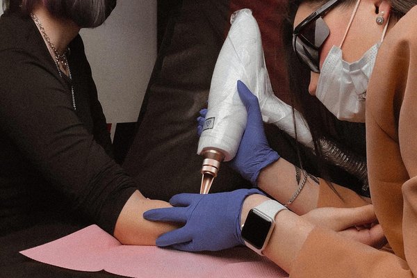 Tattoo removal in Jelenia Góra