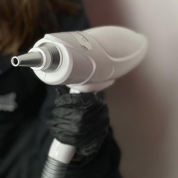 Usuwanie laserowe tatuażu permanentnego w Rzeszowie