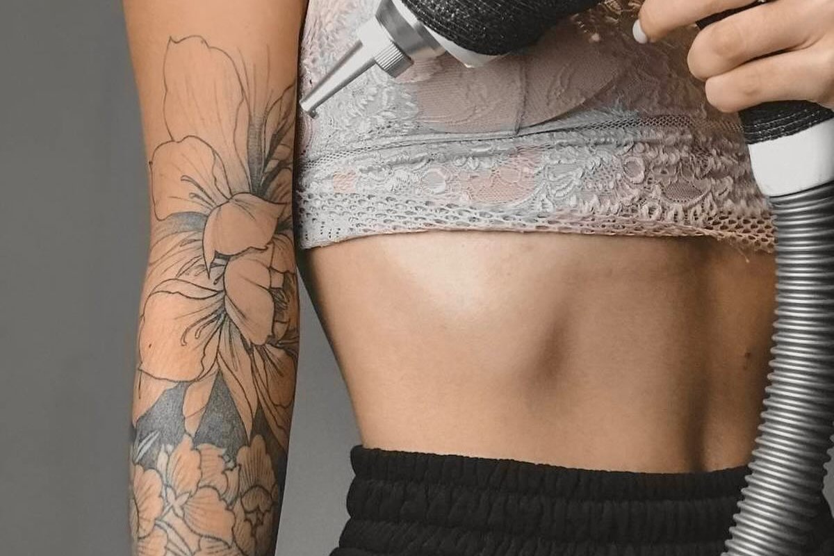 laser tattoo removal Bielsko-Biała