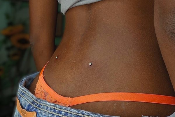 Dwa microdermale na dolnej części pleców