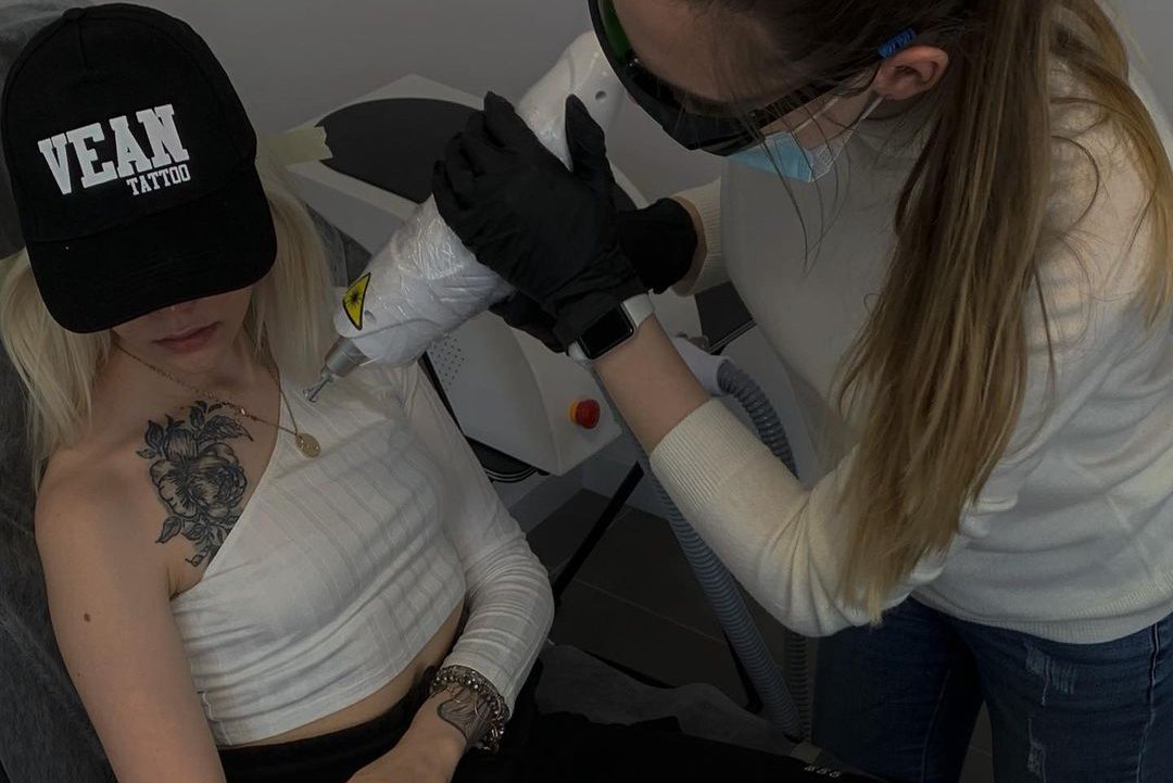 Usuwanie tatuażu we Wrocławiu