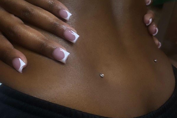 Dwa microdermale w dołkach lędźwiowych