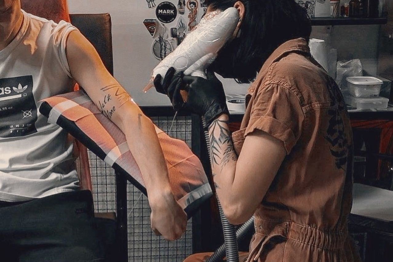 laser tattoo removal Bialystok