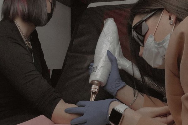 Laser tattoo removal in Katowice