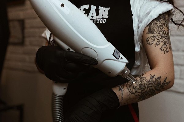 Laserowe usuwanie tatuaży w Kołobrzegu