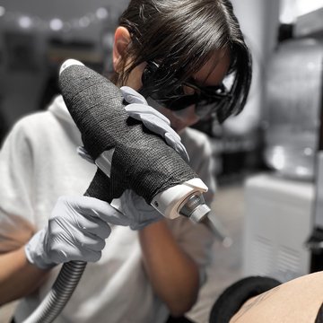 Laser tattoo removal in Katowice