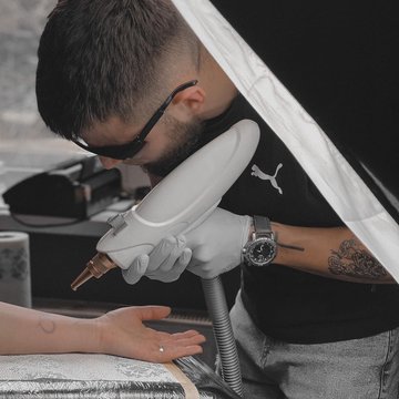 Laser tattoo removal in Katowice