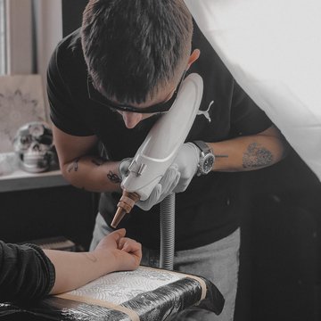 Laser tattoo removal in Katowice