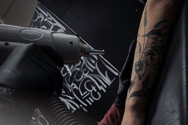 laser tattoo removal Bielsko-Biała