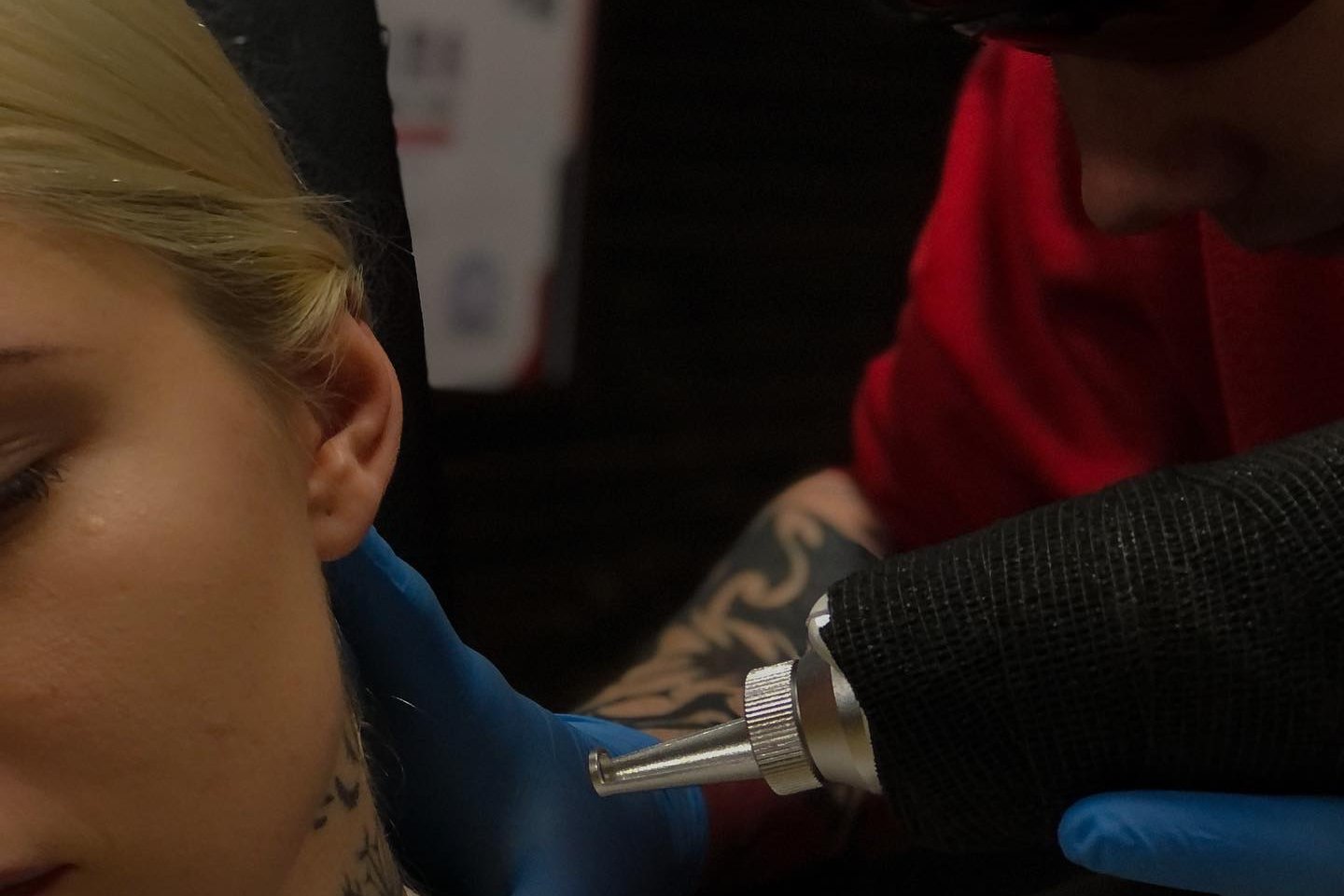 Tattoo removal in Jelenia Góra