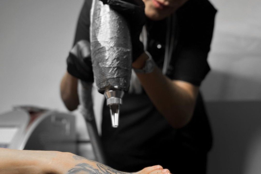 tattoo removal Gdansk