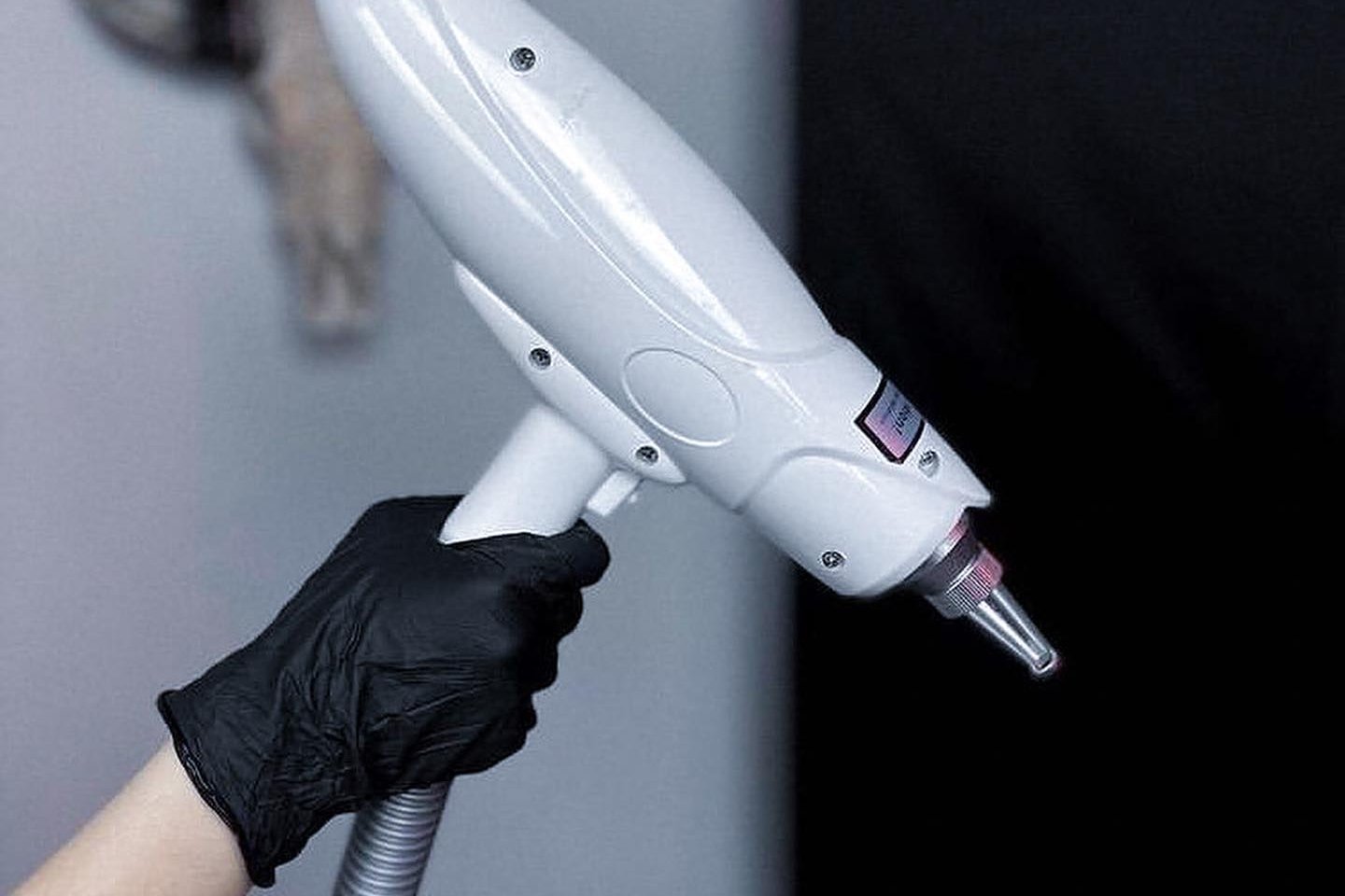 Laser removal of permanent makeup in Kalish