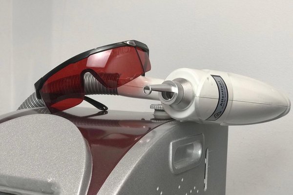 Tattoo Removal in Gliwice