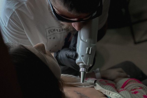laser tattoo removal Bielsko-Biała