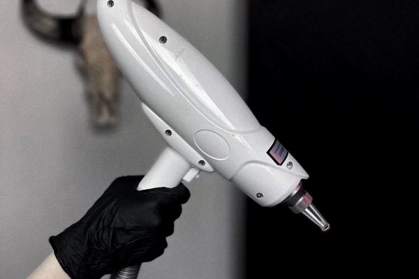 laser tattoo removal Bielsko-Biała