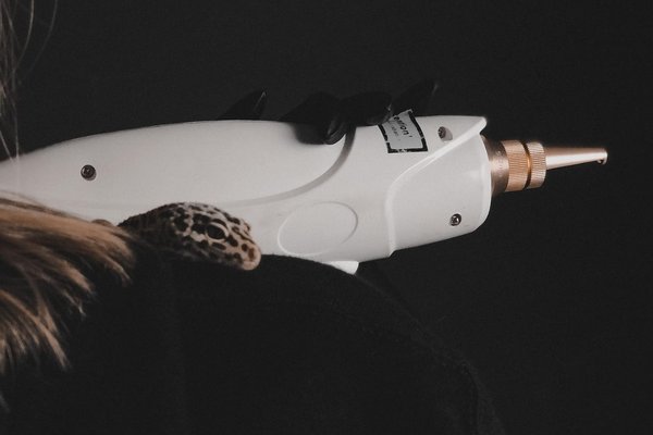 Laser removal of permanent makeup in Kalish
