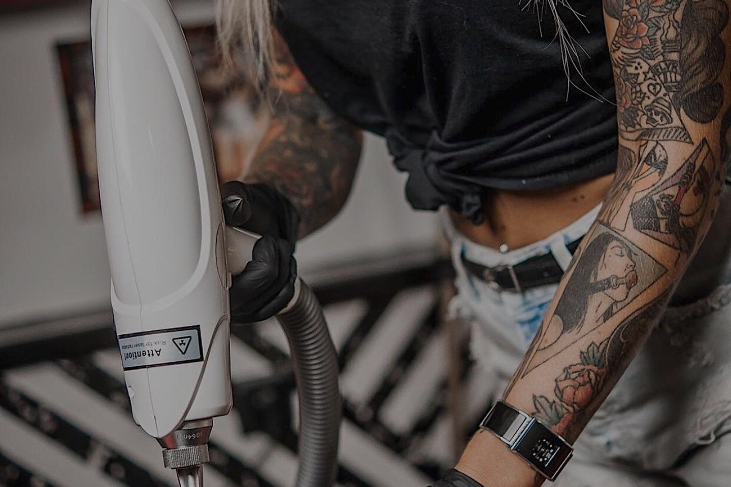 laser tattoo removal Bielsko-Biała