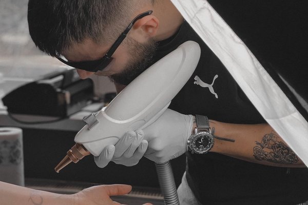 Tattoo Removal in Gliwice