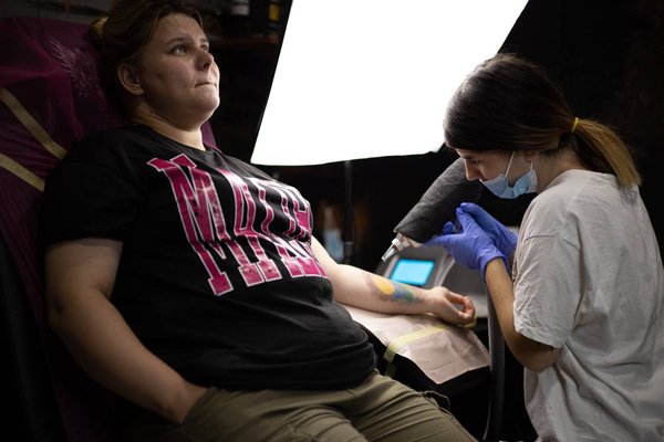 Tattoo removal Warsaw