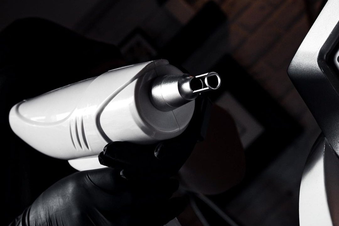 Laser Tattoo Removal in Poznan