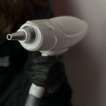 Laser Removal of Permanent Makeup in Poznan