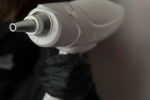 permanent makeup removal Szczecin