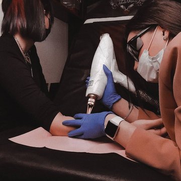 Tattoo Removal in Krakow