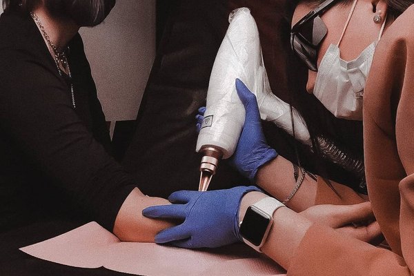 Tattoo Removal in Gdynia