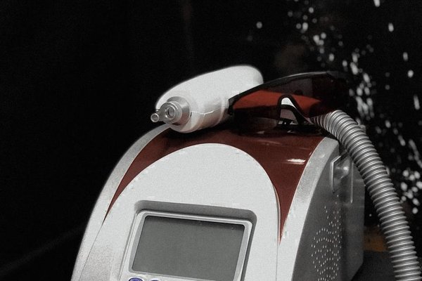 Laserowe usuwanie tatuażu w Gdańsku