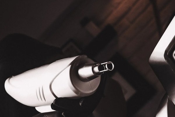 Laserowe usuwanie permanentu w Gdańsku