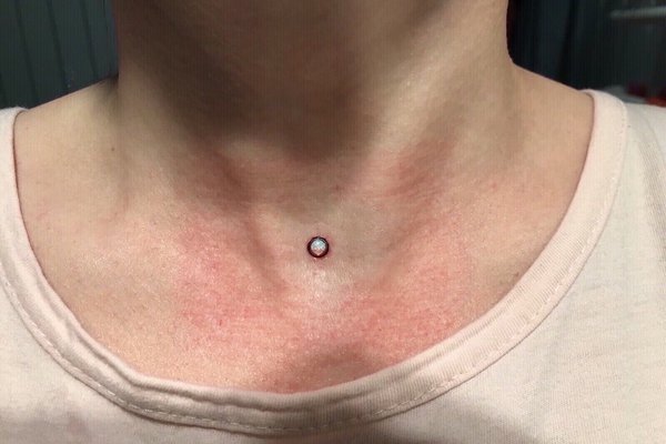 Piercing microdermal