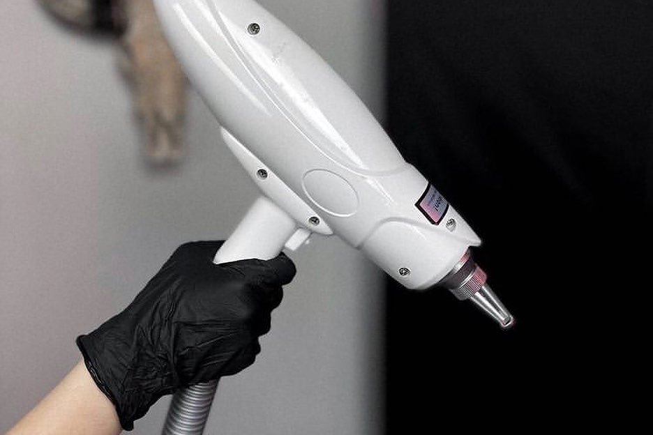 Laserowe usuwanie makijażu permanentnego w Zabrzu