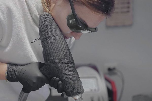 Laserowe usuwanie tatuażu w Zabrzu