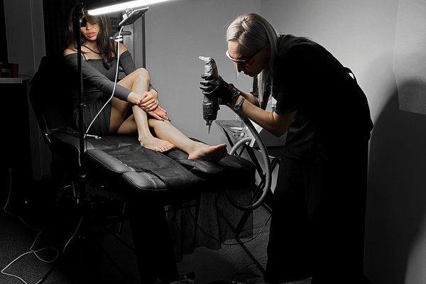 Laser Tattoo Removal in Poznan