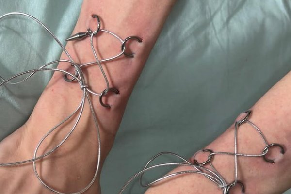 Play piercing: gorsetowe wiązanie na nadgarstkach