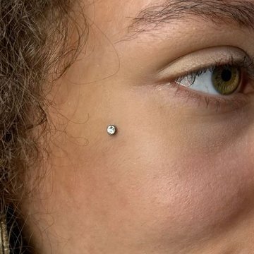 Microdermal pod okiem – pojedynczy kryształek