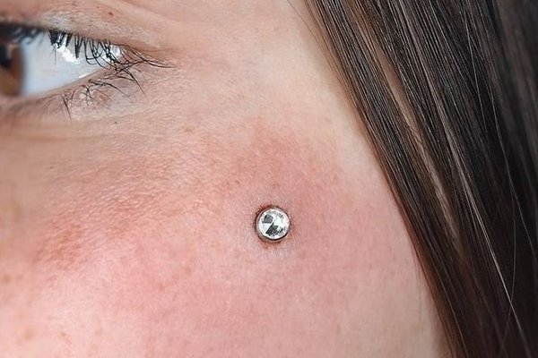 Microdermal pod okiem – pojedynczy kryształekMicrodermal na dekolcie - pojedynczy kryształek