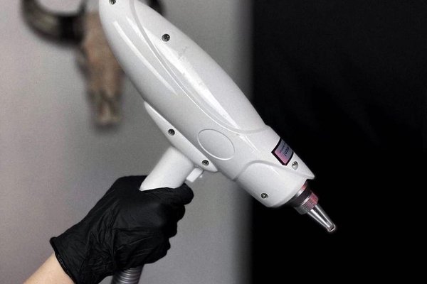 Usuwanie laserowe tatuażu permanentnego w Kielcach
